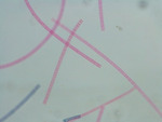 MISSING THUMBNAIL